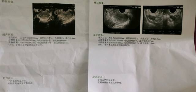河南郑州男孩的三代供精