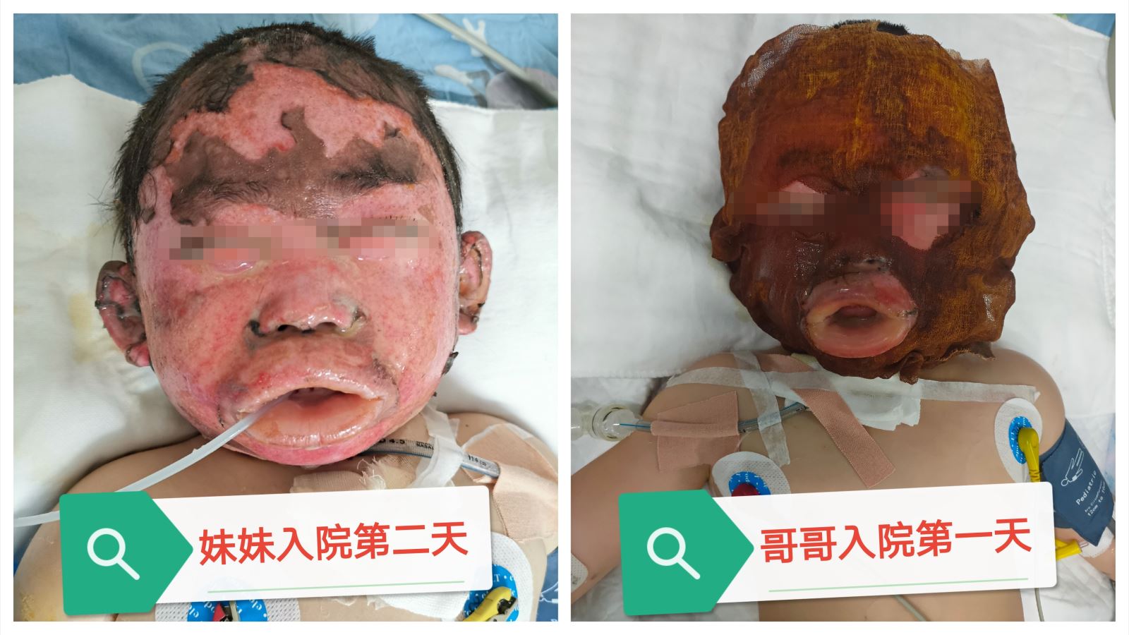 如果我的供卵试管移植总是失败，我该怎么办？看看你是否有这些问题