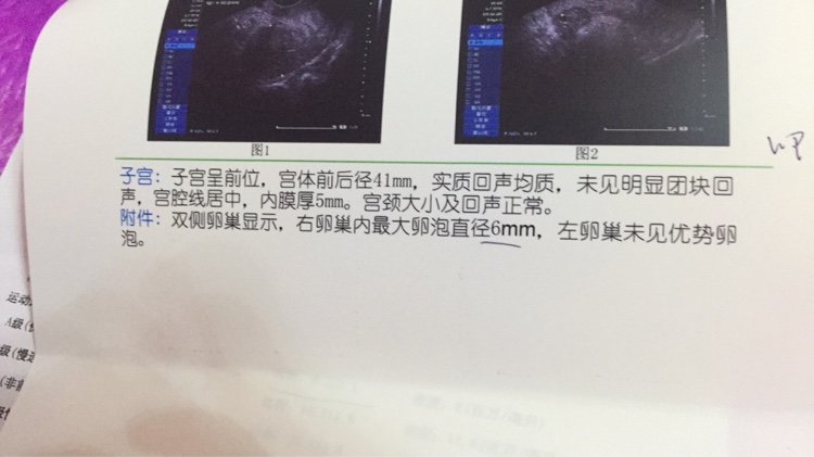 借卵做试管婴儿取卵后什么时候吃加尼瑞克，是上午吃还是下午吃？