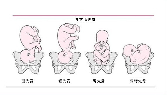 做供卵试管婴儿一次成功的人基本都有这四个好，是你吗？