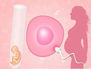 郑州做第供卵产子费用需要排队吗_选性别出生全过程